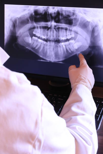 Best Emergency Treatment for Dental Infections or Abscesses in Medford, NY